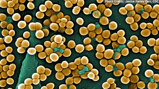 Staph. Aureus MRSA