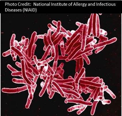 tuberculosis
