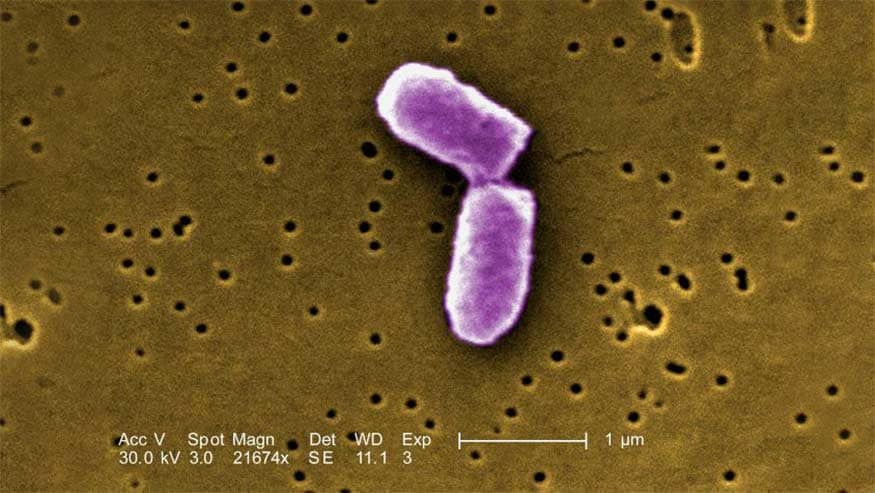 e.coli under a microscope