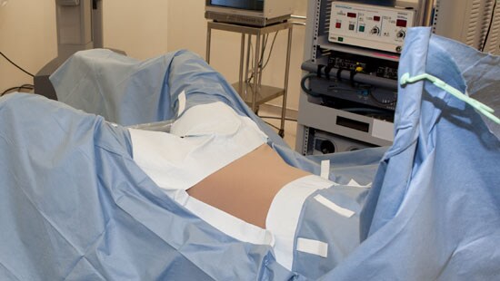 Robotic Assisted Draping Solution with larger abdominal fenestration